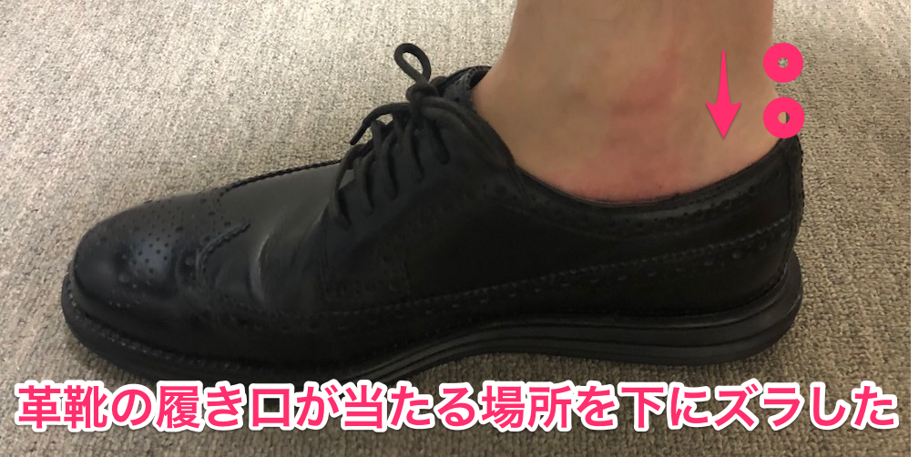 革靴の靴擦れが痛い箇所